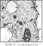 sars_coronavirus.gif (8650 bytes)